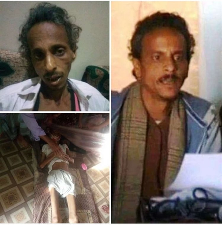  حقوق الإنسان تحمل الحوثيين مسؤولية تعذيب صحفي حتى الموت