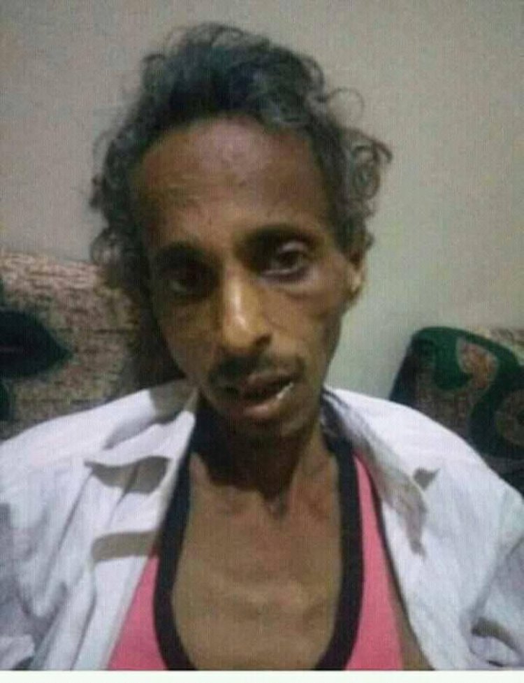 "صدى" تدين بشدة جريمة تعذيب مليشيا الحوثي الصحفي أنور الركن  حتى الموت